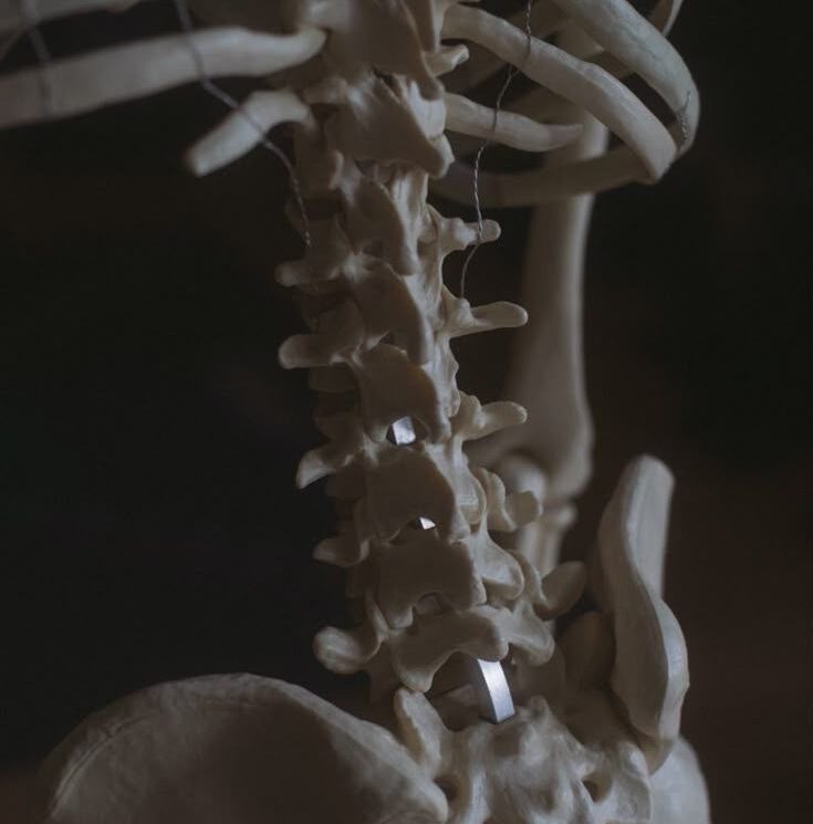 Osteopathie Bandscheibenvorfall